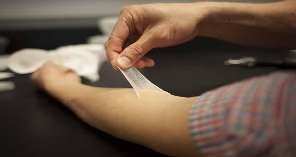 محققان پوست مصنوعی برای الیتام زخم تولید کردند
