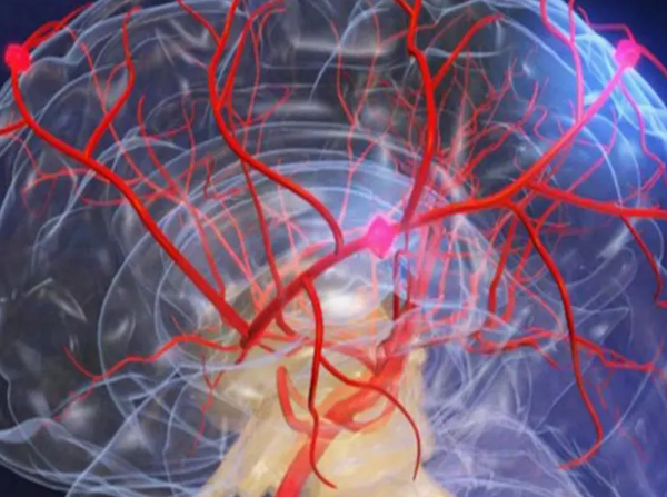 تأثیر رگ های خونی بر سلامت مغز