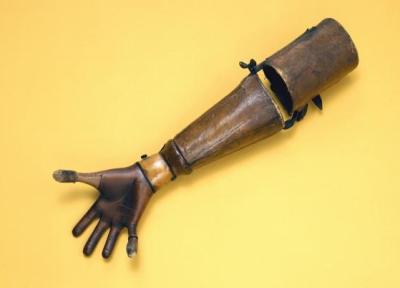 عجیب ترین دست مصنوعی یک زن در موزه علوم لندن!